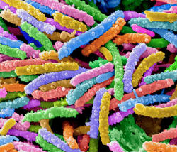 Вчені: загроза від бактерій стає глобальною 