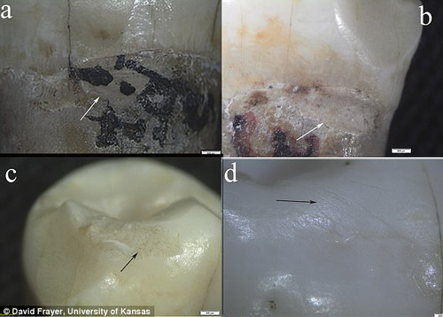 На зубах неандертальцев найдены следы лечения