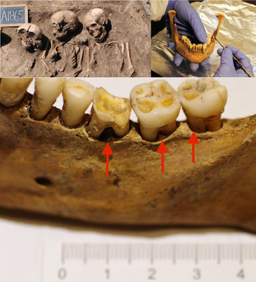 Опровергнут миф о "плохих зубах" средневековых европейцев