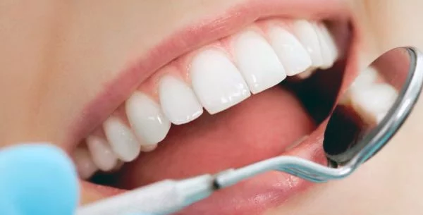 зубні імпланти